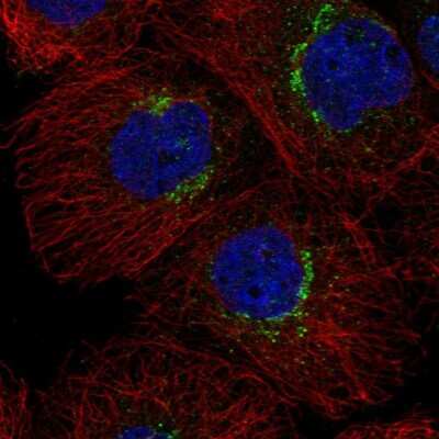 Immunocytochemistry/ Immunofluorescence: RER1 Antibody [NBP2-57144]