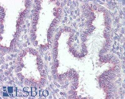 Immunohistochemistry-Paraffin: RER1 Antibody [NBP1-00234]