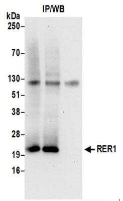 Immunoprecipitation: RER1 Antibody [NBP2-37700]