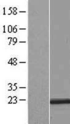 Western Blot: RER1 Overexpression Lysate [NBL1-15283]