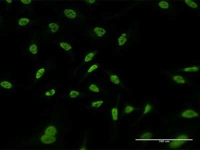 Immunocytochemistry/ Immunofluorescence: RERE Antibody (2F2) [H00000473-M06]