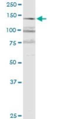 Western Blot: RERE Antibody (2F2) [H00000473-M06]