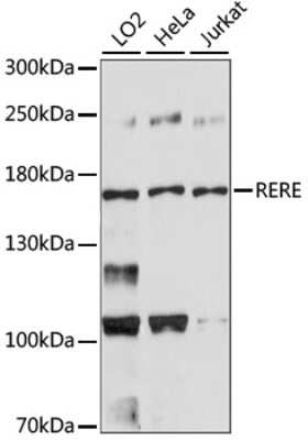 Western Blot: RERE AntibodyAzide and BSA Free [NBP2-94613]