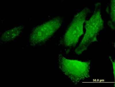 Immunocytochemistry/ Immunofluorescence: RERG Antibody (1C5) [H00085004-M03]