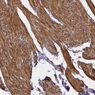 Immunohistochemistry-Paraffin: RERG Antibody [NBP1-82746]