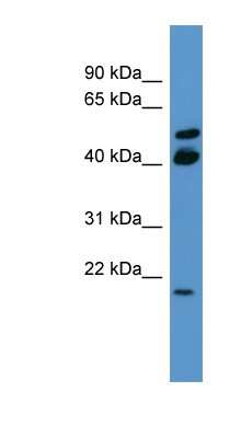 Western Blot: RERG Antibody [NBP1-68972]