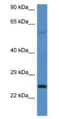 Western Blot: RERG Antibody [NBP1-79772]