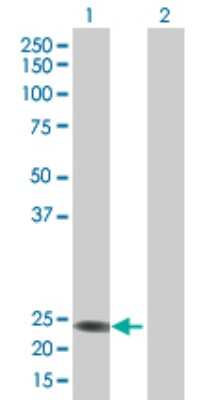 Western Blot: RERGL Antibody [H00079785-B01P]