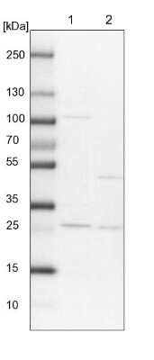 Western Blot: RERGL Antibody [NBP1-82115]