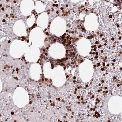 Immunohistochemistry: RESP18 Antibody [NBP2-47307]