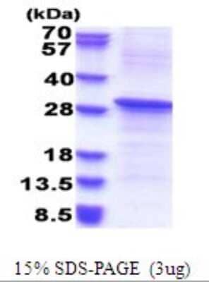 SDS-PAGE: Recombinant Human REV1 His Protein [NBP2-51681]