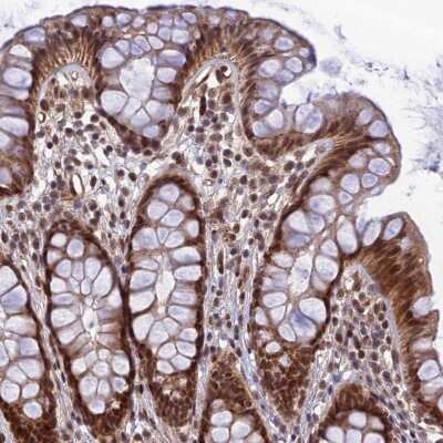 Immunohistochemistry-Paraffin: REXO1 Antibody [NBP1-84863]