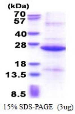 SDS-PAGE: Recombinant Human REXO1 His Protein [NBP2-51560]
