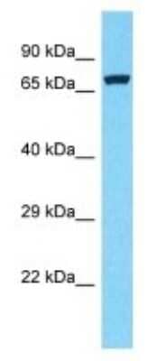 Western Blot: REXO1L1 Antibody [NBP3-09886]