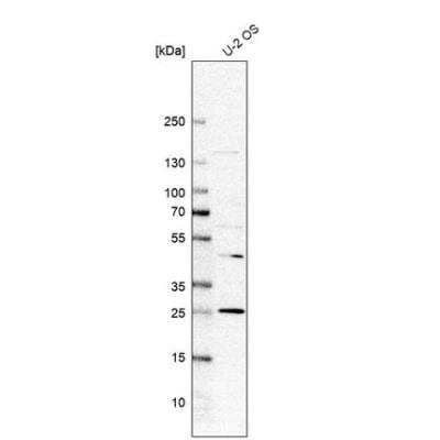 Western Blot: REXO2 Antibody [NBP1-85666]