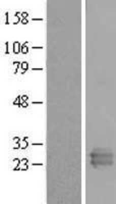 Western Blot: REXO2 Overexpression Lysate [NBL1-15291]