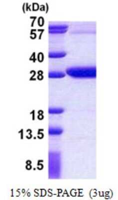 SDS-PAGE: Recombinant Human REXO2 His Protein [NBP2-23446]