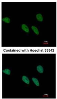 Immunocytochemistry/ Immunofluorescence: REXO4 Antibody [NBP1-31119]