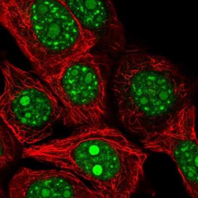 Immunocytochemistry/ Immunofluorescence: REXO4 Antibody [NBP2-13221]