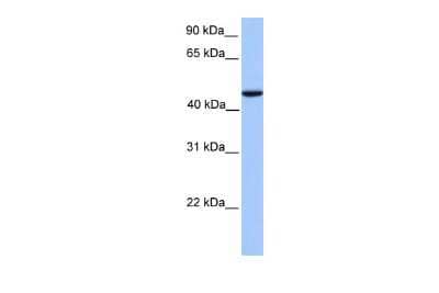 Western Blot: REXO4 Antibody [NBP2-85628]