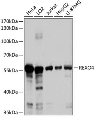 Western Blot: REXO4 AntibodyAzide and BSA Free [NBP2-93496]