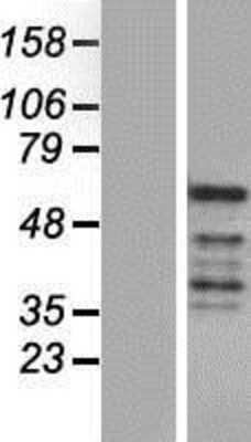 Western Blot: REXO4 Overexpression Lysate [NBP2-06655]