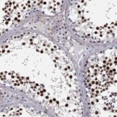 Immunohistochemistry-Paraffin: REXO5 Antibody [NBP3-17303]