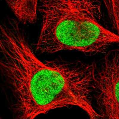 Immunocytochemistry/ Immunofluorescence: RFC1 Antibody [NBP2-54960]