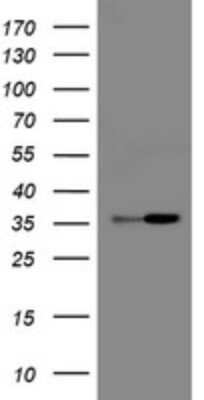 Western Blot: RFC2 Antibody (OTI11C6) [NBP2-45569]