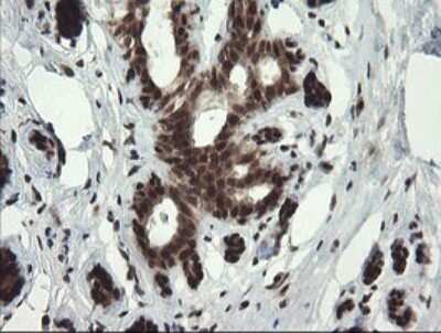 Immunohistochemistry: RFC2 Antibody (OTI2B2) [NBP2-45570]