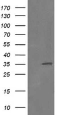 Western Blot: RFC2 Antibody (OTI2B2) [NBP2-45570]