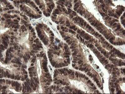 Immunohistochemistry: RFC2 Antibody (OTI2B2) - Azide and BSA Free [NBP2-73857]