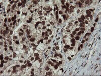 Immunohistochemistry: RFC2 Antibody (OTI2B2) - Azide and BSA Free [NBP2-73857]