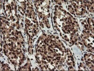Immunohistochemistry: RFC2 Antibody (OTI2B2) - Azide and BSA Free [NBP2-73857]