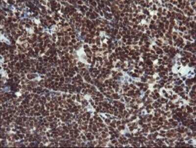 Immunohistochemistry: RFC2 Antibody (OTI2B2) - Azide and BSA Free [NBP2-73857]
