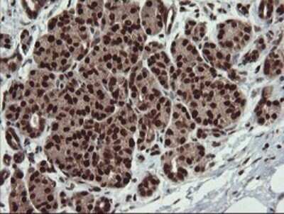 Immunohistochemistry: RFC2 Antibody (OTI2B2) - Azide and BSA Free [NBP2-73857]
