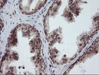 Immunohistochemistry: RFC2 Antibody (OTI2B2) - Azide and BSA Free [NBP2-73857]