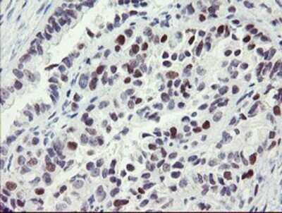 Immunohistochemistry: RFC2 Antibody (OTI4C11) - Azide and BSA Free [NBP2-73858]