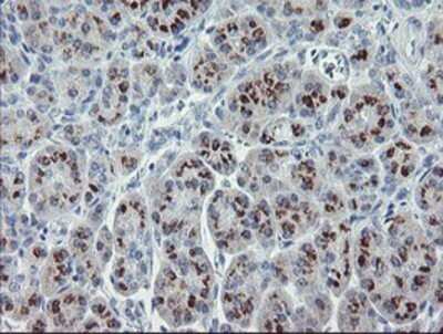 Immunohistochemistry: RFC2 Antibody (OTI4C11) - Azide and BSA Free [NBP2-73858]