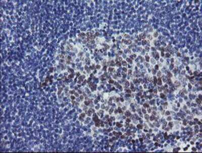 Immunohistochemistry: RFC2 Antibody (OTI4C11) - Azide and BSA Free [NBP2-73858]