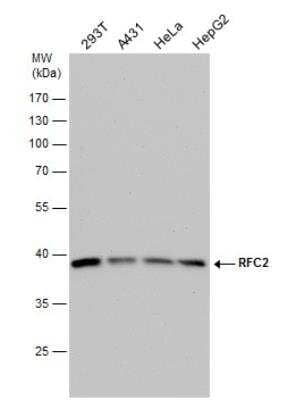 Western Blot: RFC2 Antibody [NBP1-32253]