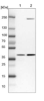 Western Blot: RFC2 Antibody [NBP1-89341]