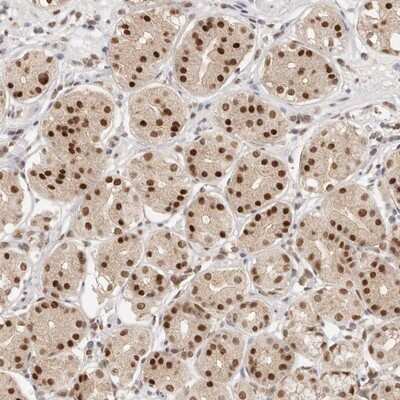 Immunohistochemistry-Paraffin: RFC3 Antibody [NBP1-82668]