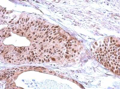 Immunohistochemistry-Paraffin: RFC3 Antibody [NBP2-20134]