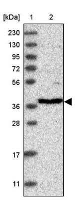 Western Blot: RFC3 Antibody [NBP1-82668]