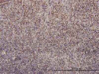 Immunohistochemistry-Paraffin: RFC4 Antibody (1C12) [H00005984-M01]