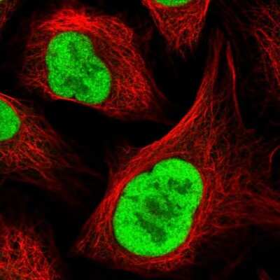 Immunocytochemistry/ Immunofluorescence: RFC4 Antibody [NBP2-48927]