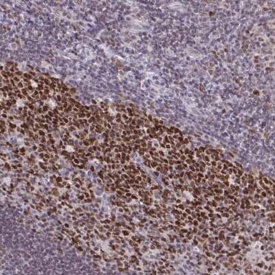 Immunohistochemistry: RFC4 Antibody [NBP2-49283]