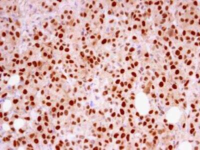 Immunohistochemistry-Paraffin: RFC4 Antibody [NBP1-33083]