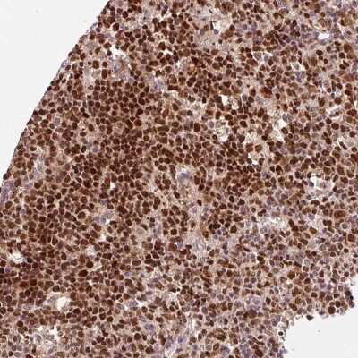 Immunohistochemistry-Paraffin: RFC4 Antibody [NBP2-48927]